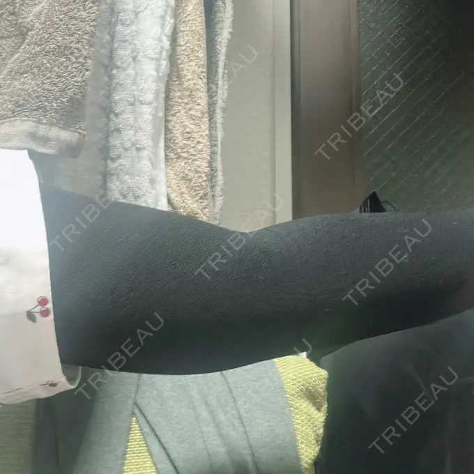 脂肪吸引（二の腕） アムルーズ美容外科クリニック 横浜院 DAY 2 メイン用