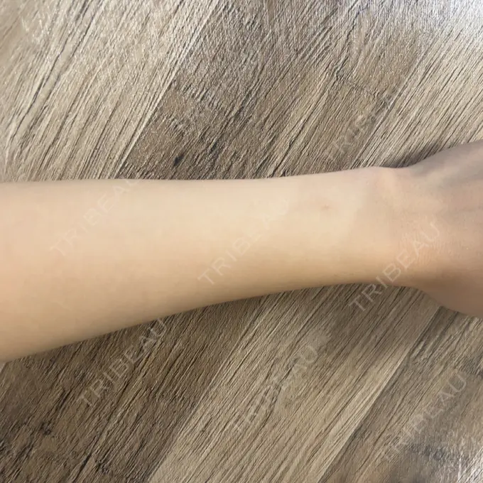 白玉点滴・注射 Mavie Beauty Clinic （マヴィービューティークリニック） AFTER メイン用