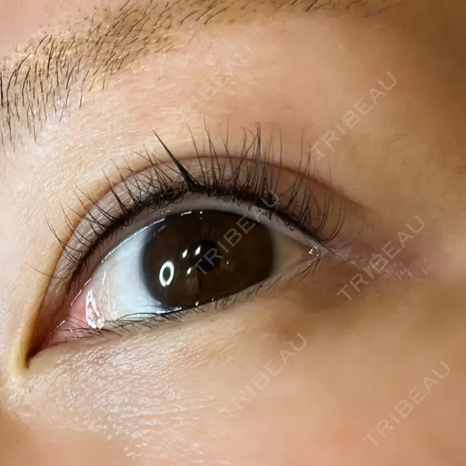 アートメイク（アイライン） 筋肉・美容クリニック AFTER メイン用