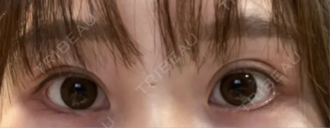 アートメイク（アイライン） Kinshicho Beauty Clinic （錦糸町ビューティークリニック） AFTER メイン用