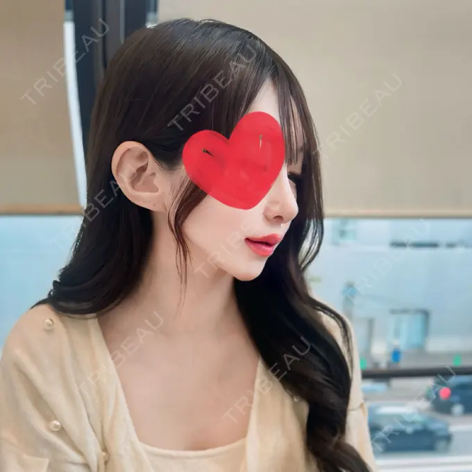 鼻尖形成（切開） / 鼻中隔延長（切開） / 軟骨移植 / 骨切幅寄せ / ワシ鼻修正・ハンプ切除 / 鼻修正 札幌ル・トロワ ビューティクリニックVogue DAY 30 メイン用