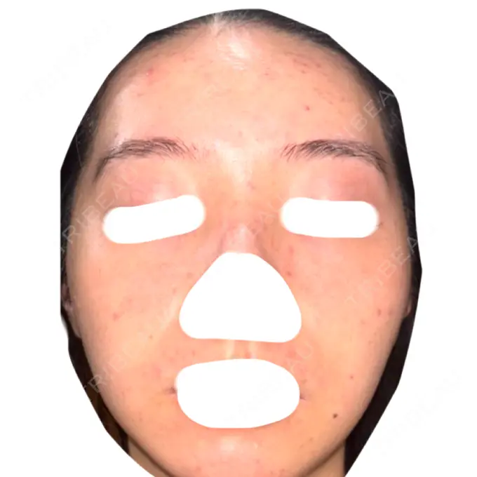 ヴェルヴェットスキン / アグネス 日本ウェルネス再生クリニック DAY 47 メイン用