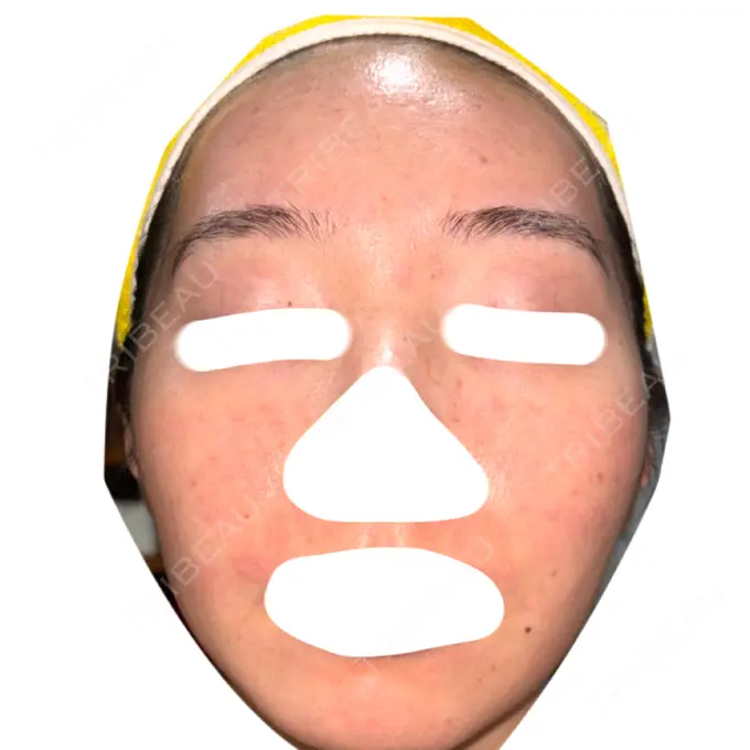 ヴェルヴェットスキン / アグネス 日本ウェルネス再生クリニック DAY 52 メイン用