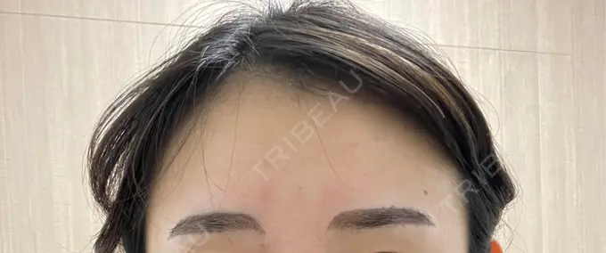 アートメイク（眉） 椿クリニック 心斎橋院 AFTER メイン用