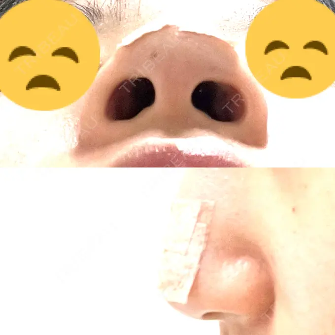 軟骨移植 R.O.clinic DAY 2 メイン用