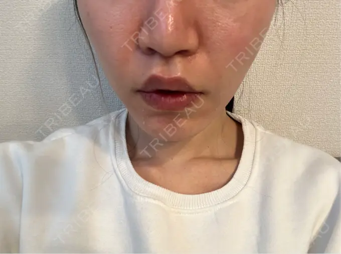 人中短縮 Otus Clinic 【オータスクリニック】 DAY 18 メイン用