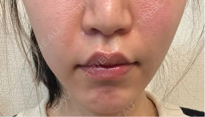 人中短縮 Otus Clinic 【オータスクリニック】 DAY 21 メイン用