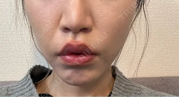 人中短縮 Otus Clinic 【オータスクリニック】 DAY 23 メイン用