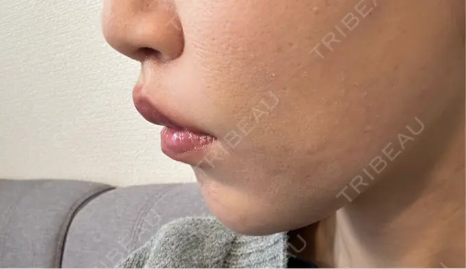 人中短縮 Otus Clinic 【オータスクリニック】 DAY 23 メイン用