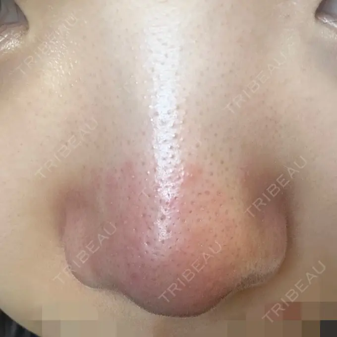 アグネス 日本美容・医療クリニック 六本木院 DAY 1 メイン用