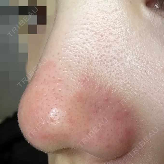 アグネス 日本美容・医療クリニック 六本木院 DAY 1 メイン用