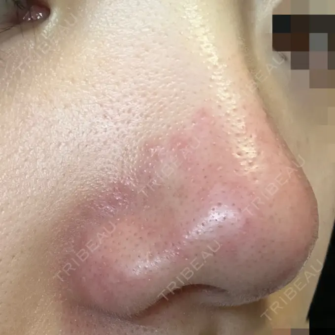 アグネス 日本美容・医療クリニック 六本木院 DAY 1 メイン用