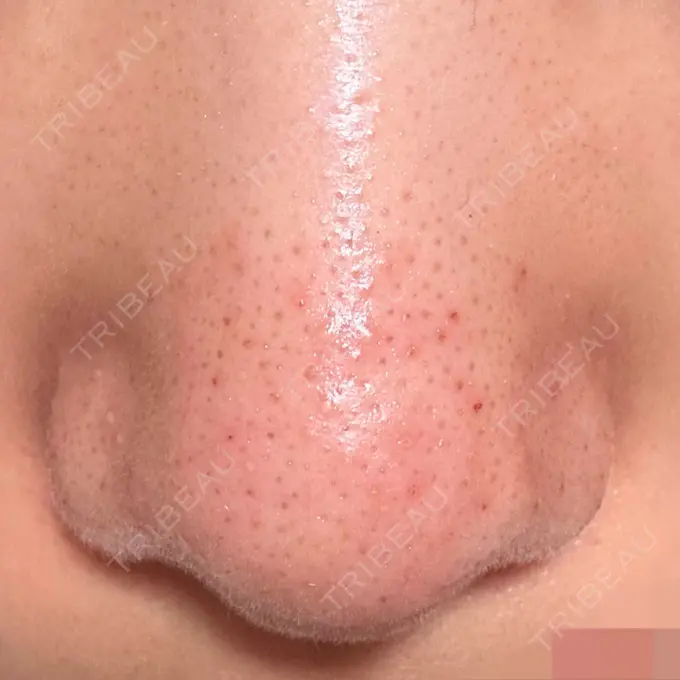 アグネス 日本美容・医療クリニック 六本木院 DAY 2 メイン用