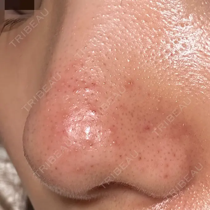 アグネス 日本美容・医療クリニック 六本木院 DAY 2 メイン用