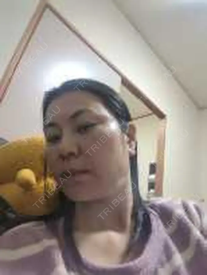 ボトックス（エラ・小顔） / 高濃度ビタミンC点滴 TCB東京中央美容外科 松山院 DAY 24 メイン用