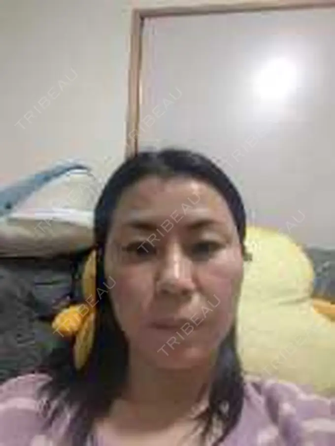 ボトックス（エラ・小顔） / 高濃度ビタミンC点滴 TCB東京中央美容外科 松山院 AFTER メイン用