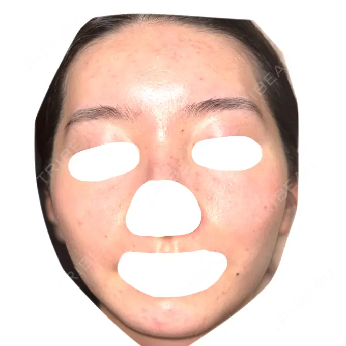 ヴェルヴェットスキン / アグネス 日本ウェルネス再生クリニック AFTER メイン用