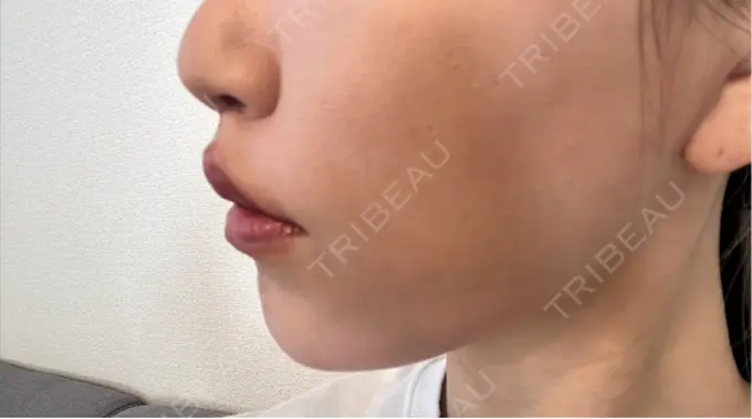 人中短縮 Otus Clinic 【オータスクリニック】 DAY 29 メイン用