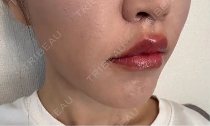 人中短縮 Otus Clinic 【オータスクリニック】 DAY 29 メイン用