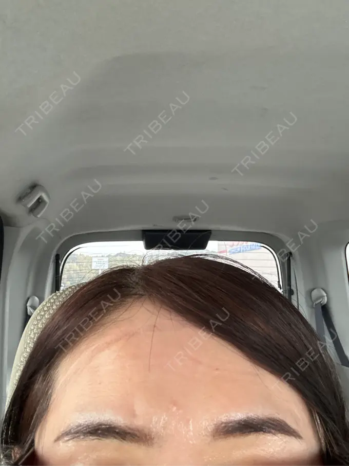 アートメイク（眉） ルーチェクリニック 銀座院 AFTER メイン用