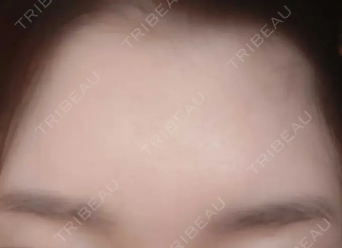 その他（肌） おおしま皮膚科 AFTER メイン用