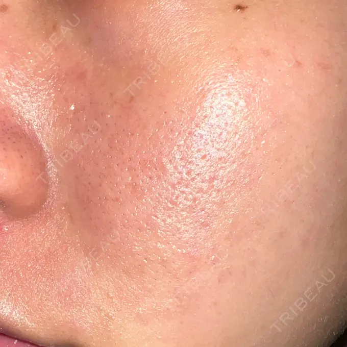 ポテンツァ REDLINE CLINIC DAY 4 メイン用