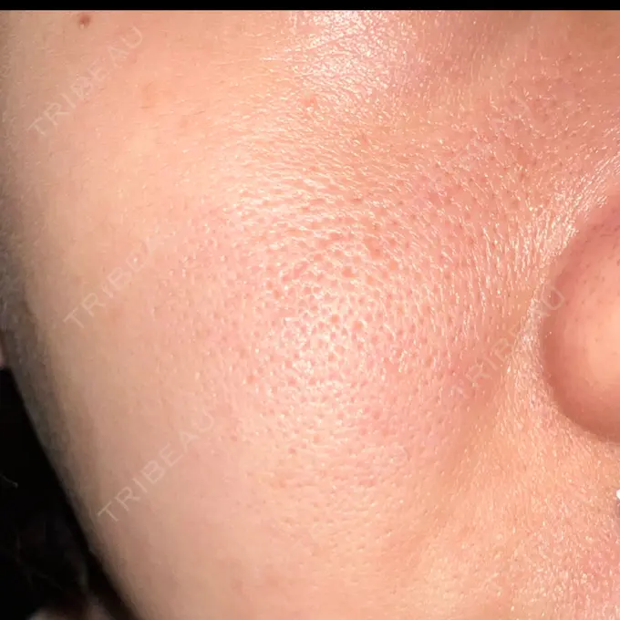 ポテンツァ REDLINE CLINIC DAY 7 メイン用