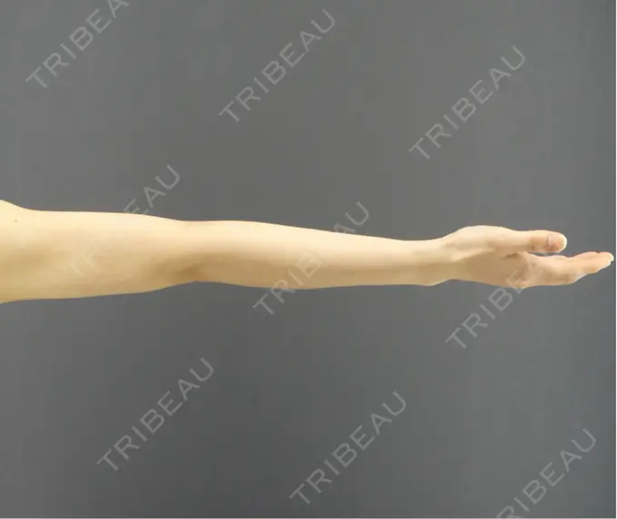 脂肪吸引（二の腕） / 脂肪吸引（肩） GRACIA clinic 【グラシアクリニック】 DAY 109 メイン用