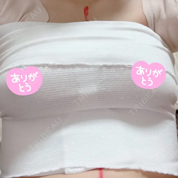 豊胸（シリコンバッグ） ジョウクリニック 那覇院 DAY 0 メイン用