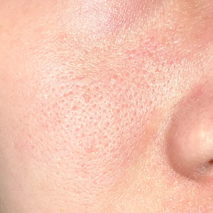 ポテンツァ REDLINE CLINIC DAY 11 メイン用