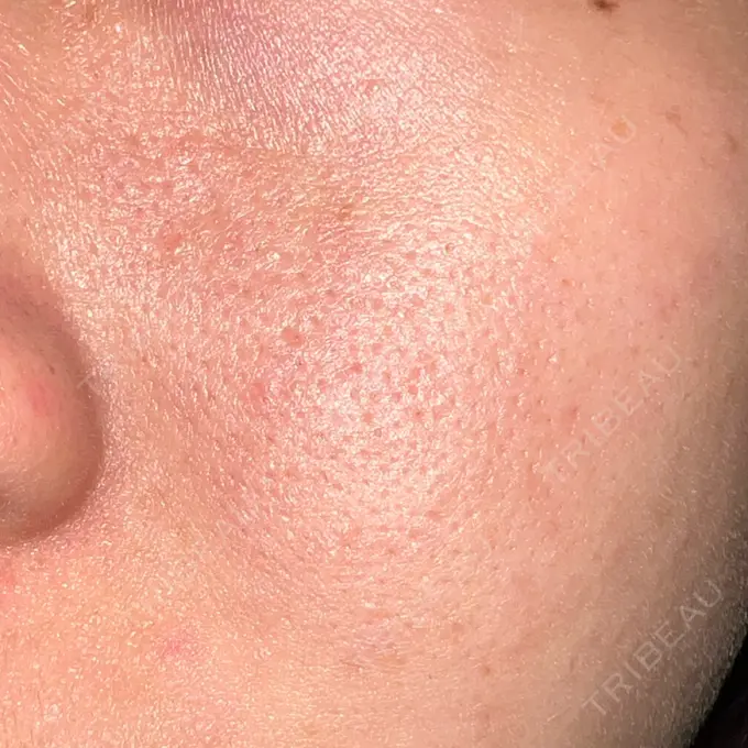 ポテンツァ REDLINE CLINIC DAY 11 メイン用