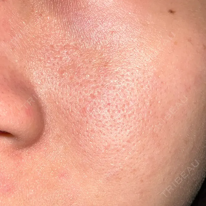 ポテンツァ REDLINE CLINIC DAY 11 メイン用