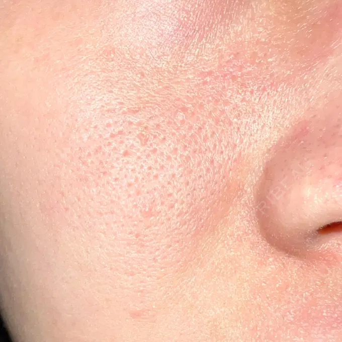 ポテンツァ REDLINE CLINIC DAY 11 メイン用