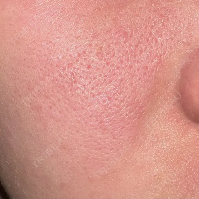 ポテンツァ REDLINE CLINIC DAY 14 メイン用