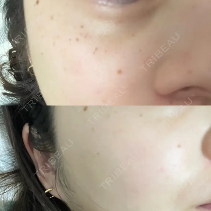 ルメッカ ルラ美容クリニック 千葉院 / ルラスキンクリニック 千葉院 DAY 0 メイン用