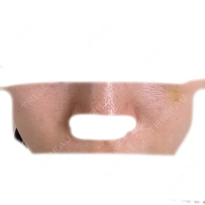 水光注射（ハリ・美肌） / 肌育注射（ジュベルックなど） / 毛穴洗浄（ハイドラフェイシャルなど） オラクル美容皮膚科 名古屋院 AFTER メイン用