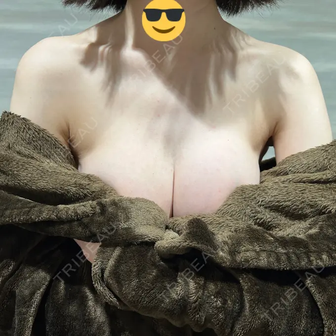 豊胸（シリコンバッグ） / 豊胸（脂肪注入） / 豊胸（シリコン＋脂肪併用） MYCLI【マイクリ】東京・恵比寿院 DAY 94 メイン用