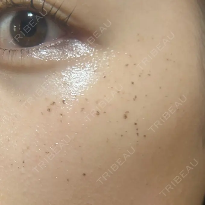 イオン導入 / ルメッカ ルラ美容クリニック 池袋院 DAY 4 メイン用