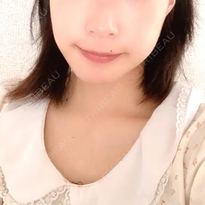 セットバック 大塚美容形成外科・歯科 大塚本院 DAY 97 メイン用