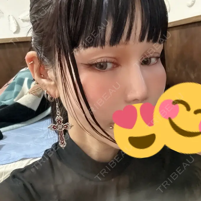 小鼻縮小（非切開） 形成外科と美容外科のクリニック池袋 AFTER メイン用