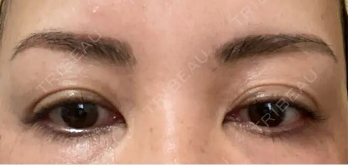 アートメイク（眉） REDLINE CLINIC DAY 9 メイン用