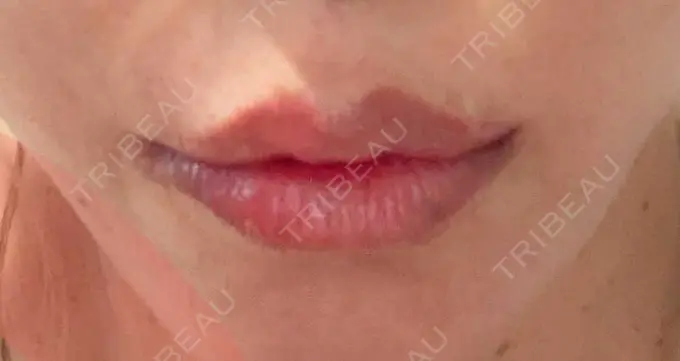 アートメイク（唇） TRUE DESIGN CLINIC DAY 0 メイン用