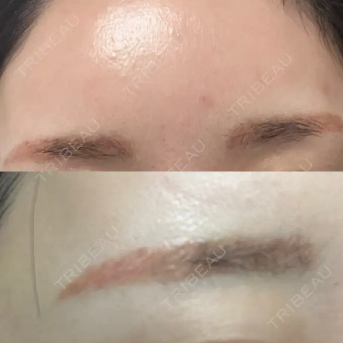 アートメイク（眉） / アートメイク除去・修正 表参道メディカルクリニック 横浜院	 DAY 0 メイン用