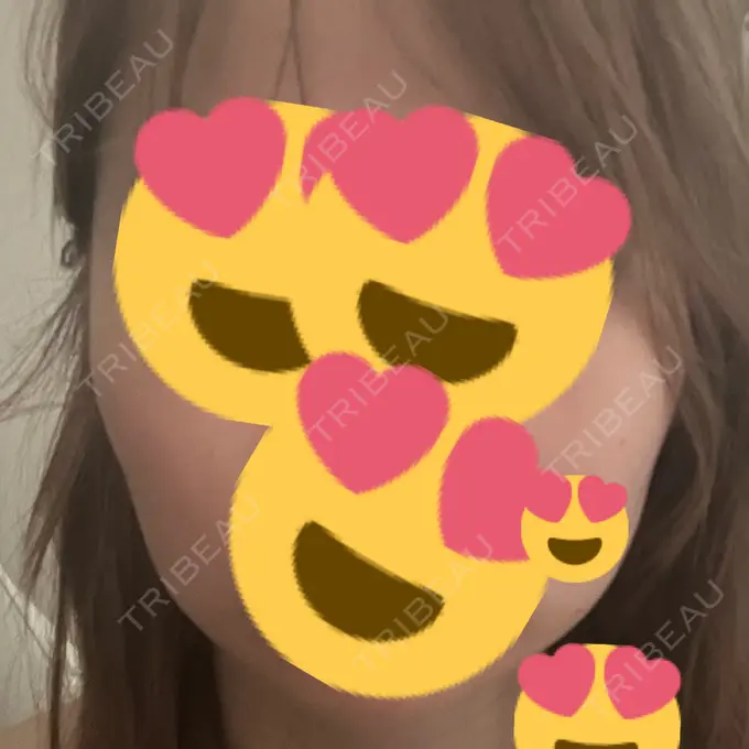 その他（輪郭） ルラ美容クリニック 名古屋本院 AFTER メイン用