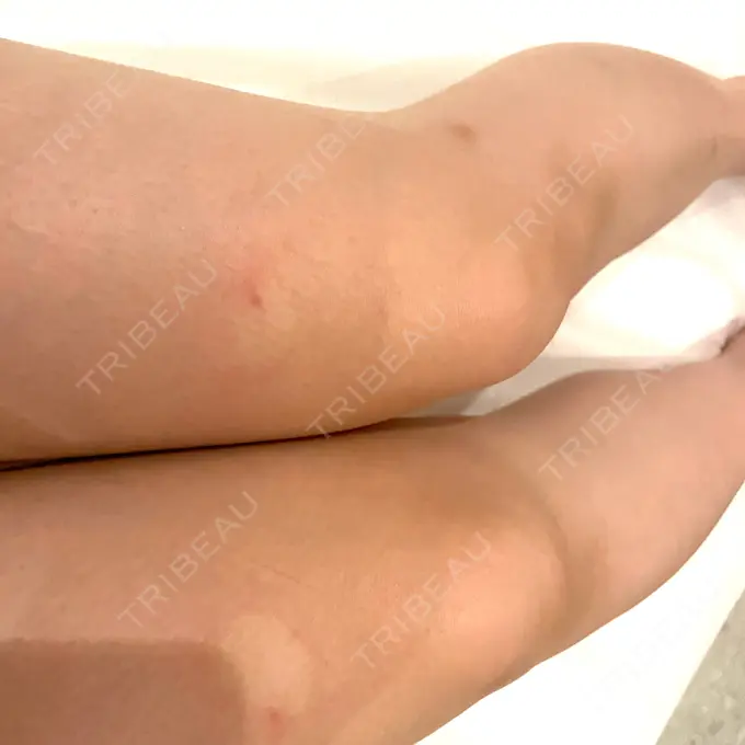 美容点滴・美容注射（ダイエット） HAAB×DREAM BEAUTY CLINIC 大阪梅田院 DAY 0 メイン用