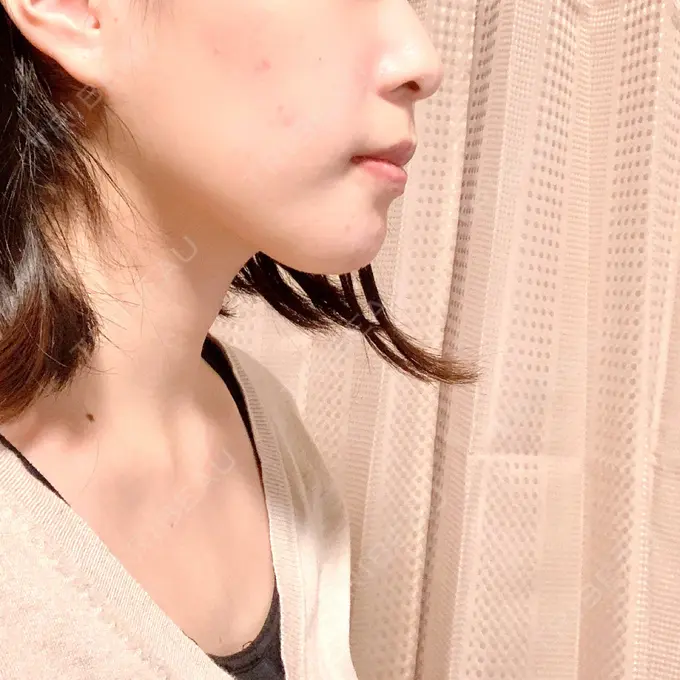 セットバック 大塚美容形成外科・歯科 大塚本院 DAY 104 メイン用