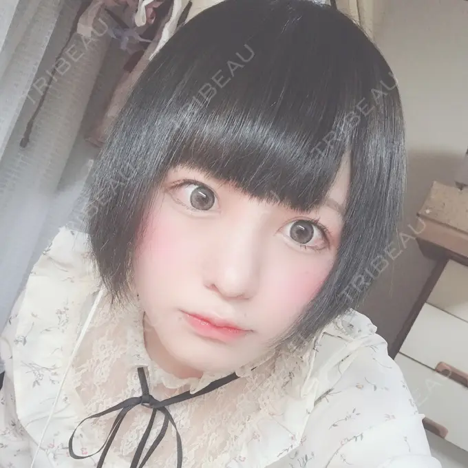 隆鼻術 / 鼻中隔延長（切開） / 鼻孔縁挙上 プリモ麻布十番クリニック DAY 28 メイン用