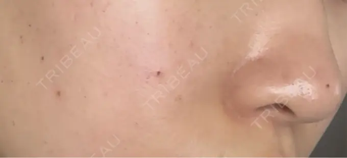 ルメッカ Grias clinic （ジリアスクリニック） DAY 2 メイン用