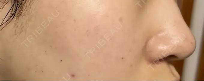 ルメッカ Grias clinic （ジリアスクリニック） DAY 4 メイン用