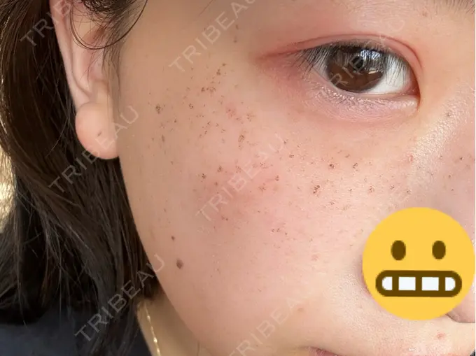 ルメッカ LIBER CLINIC DAY 1 メイン用